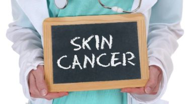 skin cancer is difficult to deal with