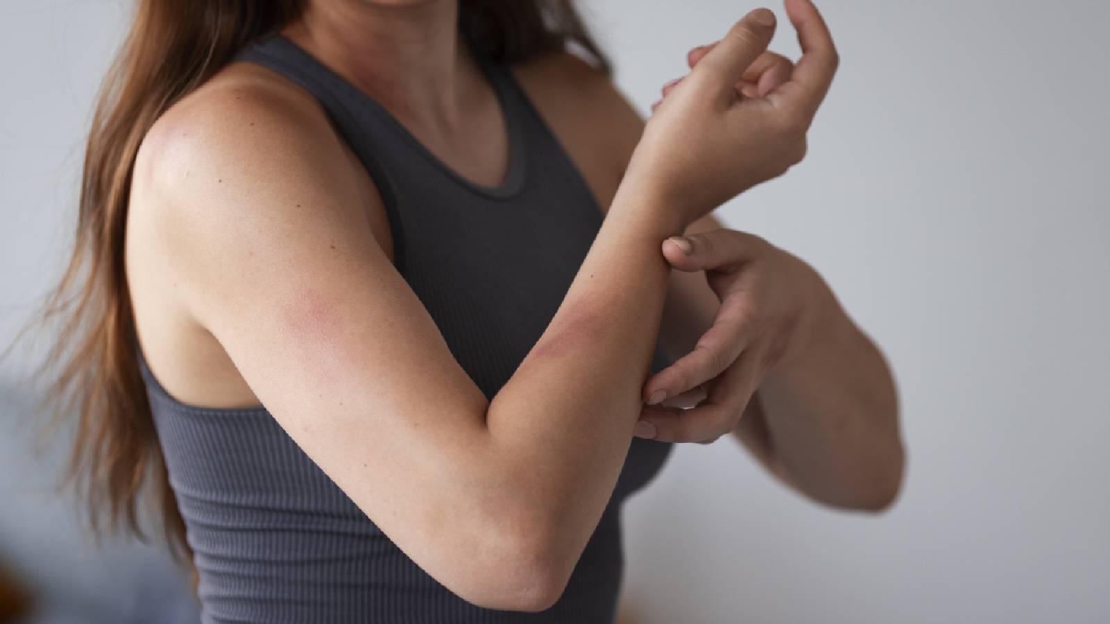 Skin rash appears due to perfume