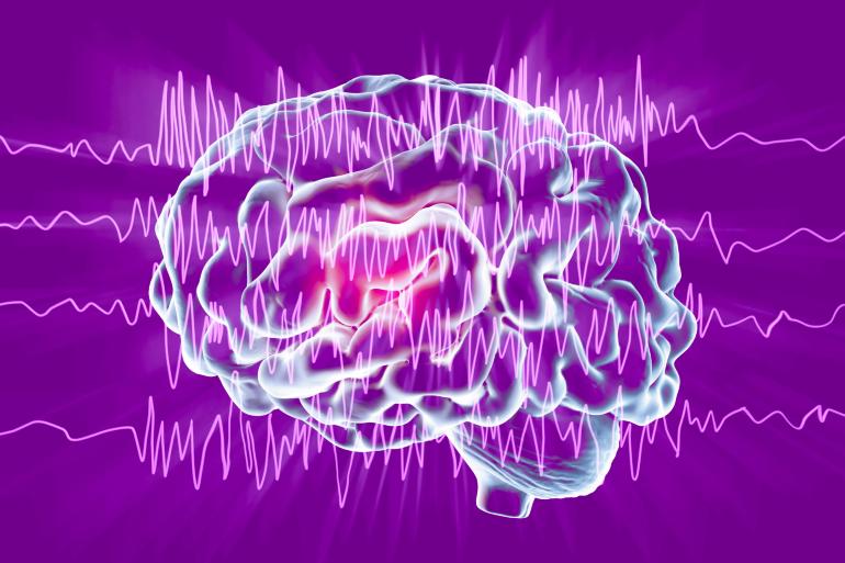 Epilepsy and seizure