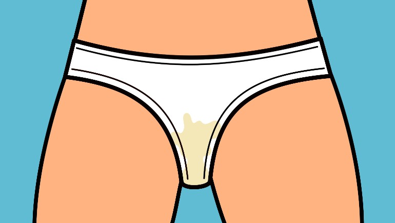 What are the potential causes and health implications of experiencing daily brown  stains, wetness, and odor in female underwear? - Poe