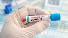 Covid antibodies might not be able to save you from future infections according to this study