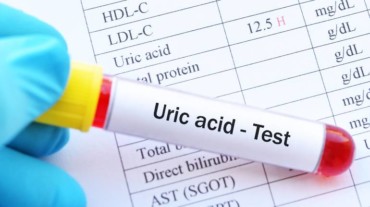 high uric acid