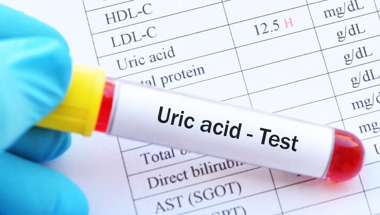 My mom got diagnosed with high uric acid. Here's everything I learnt about  the condition