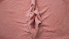 vaginal Crohn’s