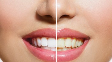 Tips for a healthy smile