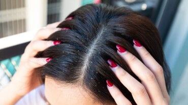 Know the side effects of hair gel before using it for style | HealthShots